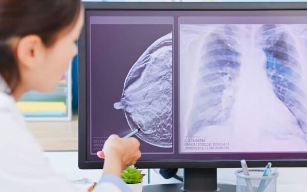 Pesquisa aponta aumento de casos de câncer de mama em mulheres jovens 