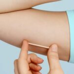 Jacareí oferece implante contraceptivo Implanon pelo SUS em todas as unidades de saúde da família