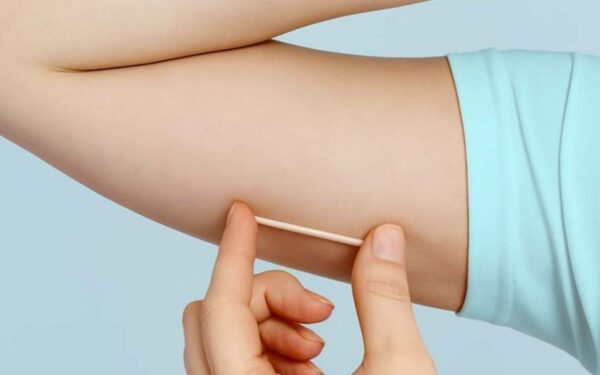 Jacareí oferece implante contraceptivo Implanon pelo SUS em todas as unidades de saúde da família