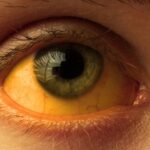 Julho Amarelo Brasil registra 826 mil casos de hepatites virais desde 2000, segundo Ministério da Saúde